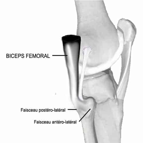 insertion distale biceps femoral douleur biceps femoral tendon biceps femorale docteur anthony wajsfisz chirurgien orthopediste specialiste du genou a paris