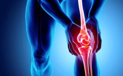 Comment soigner une ostéochondrite du genou ?