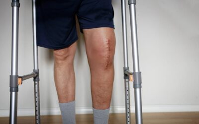 Rééducation après une opération des ligaments croisés