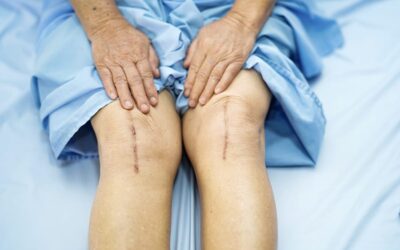 Est-il possible de poser les prothèses des deux genoux en même temps ?